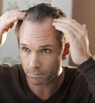 cómo evitar la caída del cabello hombres